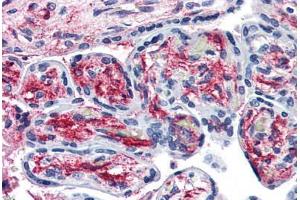 Placenta, Human: Formalin-Fixed, Paraffin-Embedded (FFPE)