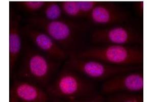 Image no. 3 for anti-Estrogen Receptor 1 (ESR1) (Ser118) antibody (ABIN197218)