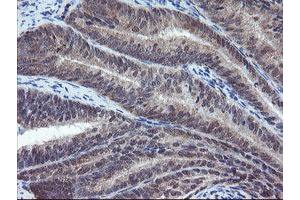 Image no. 1 for anti-Prefoldin Subunit 3 (PFDN3) antibody (ABIN1501707)