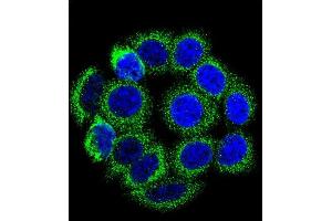 Confocal immunofluorescent analysis of CYP21A2 Antibody (Center) (ABIN652409 and ABIN2842001) with 293 cell followed by Alexa Fluor 488-conjugated goat anti-rabbit lgG (green).