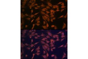 Immunofluorescence analysis of C6 cells using CENPC Rabbit mAb (ABIN7266273) at dilution of 1:100 (40x lens).