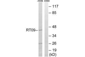 Western blot analysis of extracts from A549 cells, using MRPS9 antibody. (MRPS9 anticorps  (Internal Region))