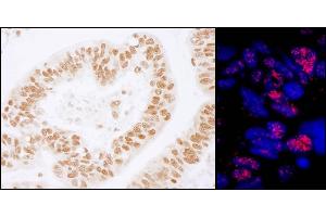 anti-Pleiotropic Regulator 1 (PLRG1) (AA 464-514) antibody