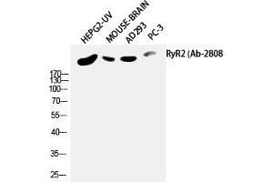 Western Blotting (WB) image for anti-Ryanodine Receptor 2 (Cardiac) (RYR2) (Ser2808) antibody (ABIN5957596)