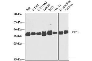 Western blot analysis of extracts of various cell lines using PPA1 Polyclonal Antibody at dilution of 1:1000. (Pyrophosphatase (Inorganic) 1 (PPA1) anticorps)