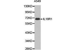 Western Blotting (WB) image for anti-Interleukin 18 Receptor 1 (IL18R1) antibody (ABIN1873199) (IL18R1 anticorps)