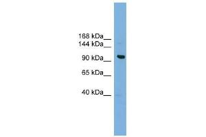 VPS41 antibody used at 0. (VPS41 anticorps  (Middle Region))