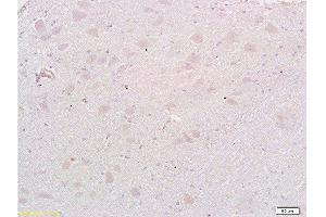 Formalin-fixed and paraffin embedded: rat brain tissue labeled with Anti-MAP1A Polyclonal Antibody , Unconjugated at 1:200, followed by conjugation to the secondary antibody and DAB staining