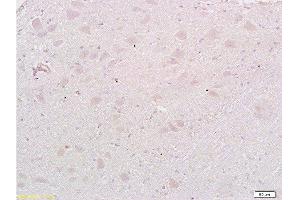 Formalin-fixed and paraffin embedded: rat brain tissue labeled with Anti-MAP1A Polyclonal Antibody , Unconjugated at 1:200, followed by conjugation to the secondary antibody and DAB staining (MAP1A anticorps  (AA 2651-2750))