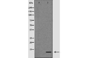 Western blot analysis of K562 cell lysate, using S100A12 Antibody. (S100A12 anticorps)
