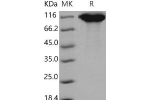 Western Blotting (WB) image for Leukemia Inhibitory Factor Receptor alpha (LIFR) (Active) protein (His tag) (ABIN7320281)