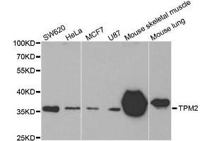 Western Blotting (WB) image for anti-Tropomyosin-2 (TPM2) antibody (ABIN1875181) (TPM2 anticorps)