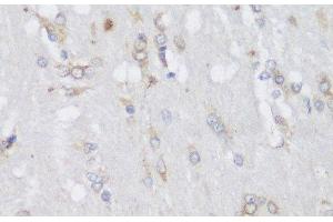 Immunohistochemistry of paraffin-embedded Rat brain using FA2H Polyclonal Antibody at dilution of 1:150 (40x lens). (FA2H anticorps)