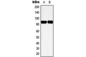 Western blot analysis of Cortactin (pY466) expression in HeLa UV-treated (A), NIH3T3 H2O2-treated (B) whole cell lysates. (Cortactin anticorps  (C-Term, pTyr466))