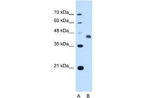 WB Suggested Anti-DFNA5 Antibody Titration:  1. (DFNA5 anticorps  (C-Term))