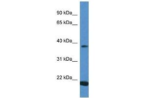 Western Blot showing IFNA13 antibody used at a concentration of 1 ug/ml against Placenta Lysate