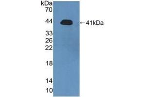 Detection of Recombinant PRH2, Human using Polyclonal Antibody to Acidic Salivary Proline Rich Phosphoprotein 2 (PRH2)