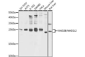 Western blot analysis of extracts of various cell lines, using MB/MB/ML2 antibody (ABIN6132319, ABIN6143422, ABIN6143424 and ABIN6216232) at 1:1000 dilution.