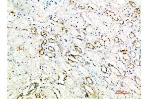 Immunohistochemical analysis of paraffin-embedded human-kidney, antibody was diluted at 1:200 (ART4 anticorps  (AA 181-230))