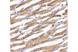 Immunohistochemistry (IHC) image for anti-CD274 (PD-L1) (Middle Region) antibody (ABIN1031034) (PD-L1 anticorps  (Middle Region))