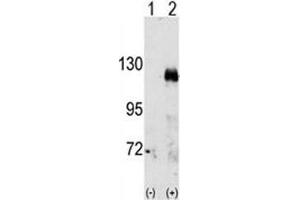 Western blot analysis of EphA3 antibody and 293 cell lysate either nontransfected (Lane 1) or transiently transfected with the EphA3 gene (2).
