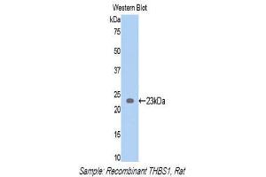 Western Blotting (WB) image for anti-Thrombospondin 1 (THBS1) (AA 71-259) antibody (ABIN1173304)