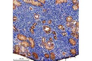 IHC analysis of P5CS/ALDH18A1 using anti-P5CS/ALDH18A1 antibody (AZA4IGC8).
