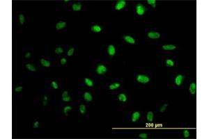 Immunofluorescence of monoclonal antibody to MPG on HeLa cell.