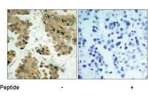 Image no. 1 for anti-V-Akt Murine Thymoma Viral Oncogene Homolog 2 (AKT2) (Ser474) antibody (ABIN197358) (AKT2 anticorps  (Ser474))