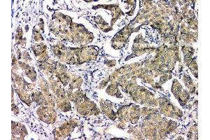 IHC analysis of EIF6 using anti-EIF6 antibody (ABIN6719594).