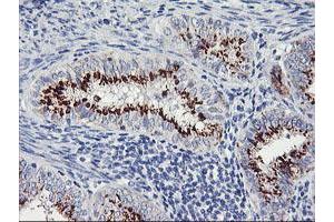 Image no. 6 for anti-Golgi Membrane Protein 1 (GOLM1) antibody (ABIN1498494) (GOLM1 anticorps)