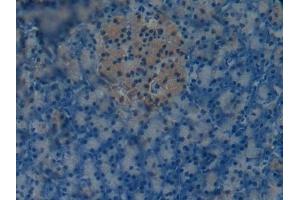 Detection of OC in Mouse Pancreas Tissue using Polyclonal Antibody to Osteocalcin (OC)