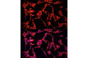 Immunofluorescence analysis of PC-12 cells using  Polyclonal Antibody (ABIN6129956, ABIN6136944, ABIN6136945 and ABIN6221849) at dilution of 1:100 (40x lens).