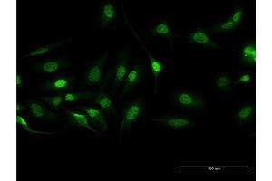 Immunofluorescence of monoclonal antibody to BCR on HeLa cell.