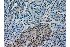 Immunohistochemical staining of paraffin-embedded pancreas tissue using anti-FERMT2mouse monoclonal antibody. (FERMT2 anticorps)