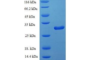 SDS-PAGE (SDS) image for Phospholipase A2, Group IID (PLA2G2D) (AA 22-145), (partial) protein (His-SUMO Tag) (ABIN5711953)