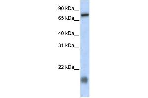 WB Suggested Anti-C21orf13 Antibody Titration:  0. (LCA5L anticorps  (N-Term))