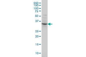 POU4F3 monoclonal antibody (M01), clone 5B8 Western Blot analysis of POU4F3 expression in Hela S3 NE .