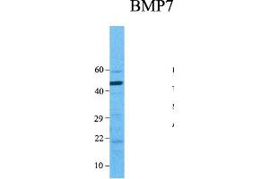 Host:  Rabbit  Target Name:  BMP7  Sample Type:  Human Fetal Intestine  Antibody Dilution:  0.
