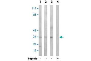 Western blot analysis of extracts from HeLa cells (Lane 1 and lane 4), HepG2 cells (Lane 2) and MCF-7 cells (Lane 3), using RRAD polyclonal antibody . (RRAD anticorps)