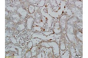 Formalin-fixed and paraffin embedded rat colitis tissue labeled with Rabbit Anti-L-Selectin/CD62L Polyclonal Antibody (ABIN736716), Unconjugated 1:200 followed by conjugation to the secondary antibody and DAB staining