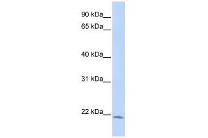 LIN7C antibody used at 1 ug/ml to detect target protein. (LIN7C anticorps)