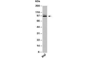 Western blot testing of human samples with TRIL antibody at 2ug/ml. (TRIL anticorps  (C-Term))