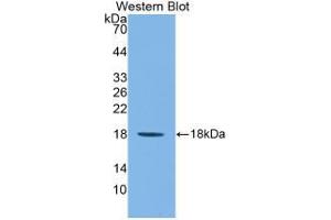 Western blot analysis of recombinant Mouse IL1F9.