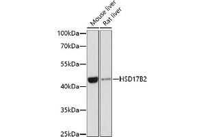 Western blot analysis of extracts of various cell lines, using HSD17B2 antibody (ABIN3015794, ABIN3015795, ABIN3015796 and ABIN6219142) at 1:1000 dilution. (HSD17B2 anticorps  (AA 118-387))
