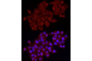 Immunofluorescence analysis of HeLa cells using VEGFA Rabbit pAb (ABIN6128908, ABIN6150086, ABIN6150088 and ABIN6221373) at dilution of 1:100 (40x lens). (VEGFA anticorps  (AA 1-147))