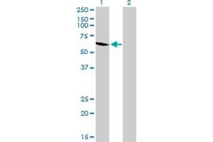 Western Blot analysis of UGP2 expression in transfected 293T cell line by UGP2 monoclonal antibody (M01), clone 3H3.