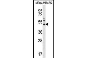 Western blot analysis in MDA-MB435 cell line lysates (35ug/lane). (MMP16 anticorps  (N-Term))