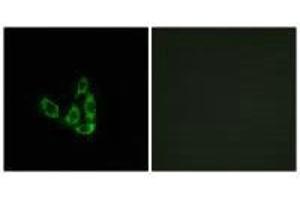 Immunofluorescence analysis of A549 cells, using GCNT3 antibody.