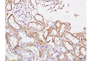 Formalin-fixed and paraffin embedded rat brain labeled with Anti CRHR2/Corticotropin Releasing Factor Receptor 2 Polyclonal Antibody, Unconjugated (ABIN680773) at 1:200 followed by conjugation to the secondary antibody and DAB staining